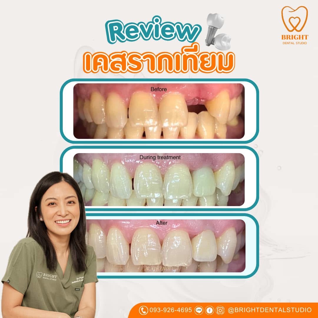 Bright Dental Studio | Gallery